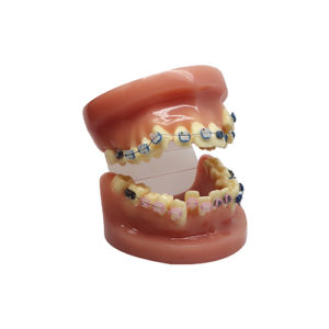 Accesorios ortodoncia